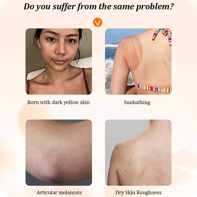 🔥 Kaufen Sie 2 und erhalten Sie 3 gratis 🔥 Multifunktionaler feuchtigkeitsspendender Concealer mit Niacinamid