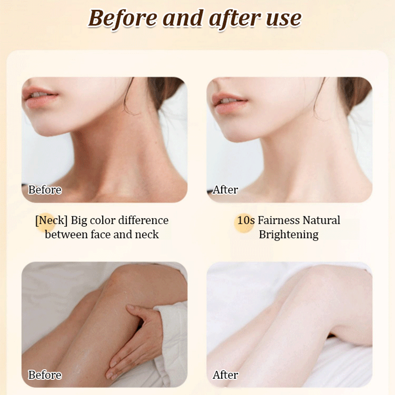🔥 Kaufen Sie 2 und erhalten Sie 3 gratis 🔥 Multifunktionaler feuchtigkeitsspendender Concealer mit Niacinamid