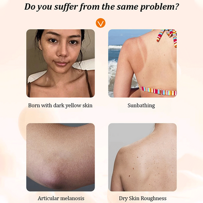 🔥 Kaufen Sie 2 und erhalten Sie 3 gratis 🔥 Multifunktionaler feuchtigkeitsspendender Concealer mit Niacinamid