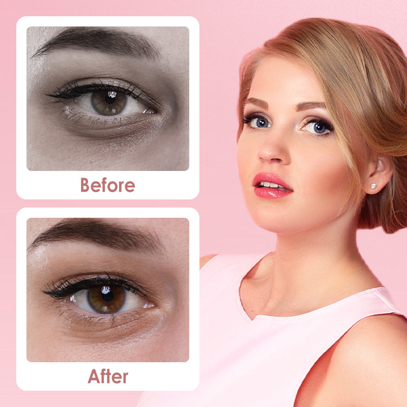 ✨📢1 kaufen 1 gratis dazu🔥Verwischen Sie das Erscheinungsbild unter den Augen Aufheller