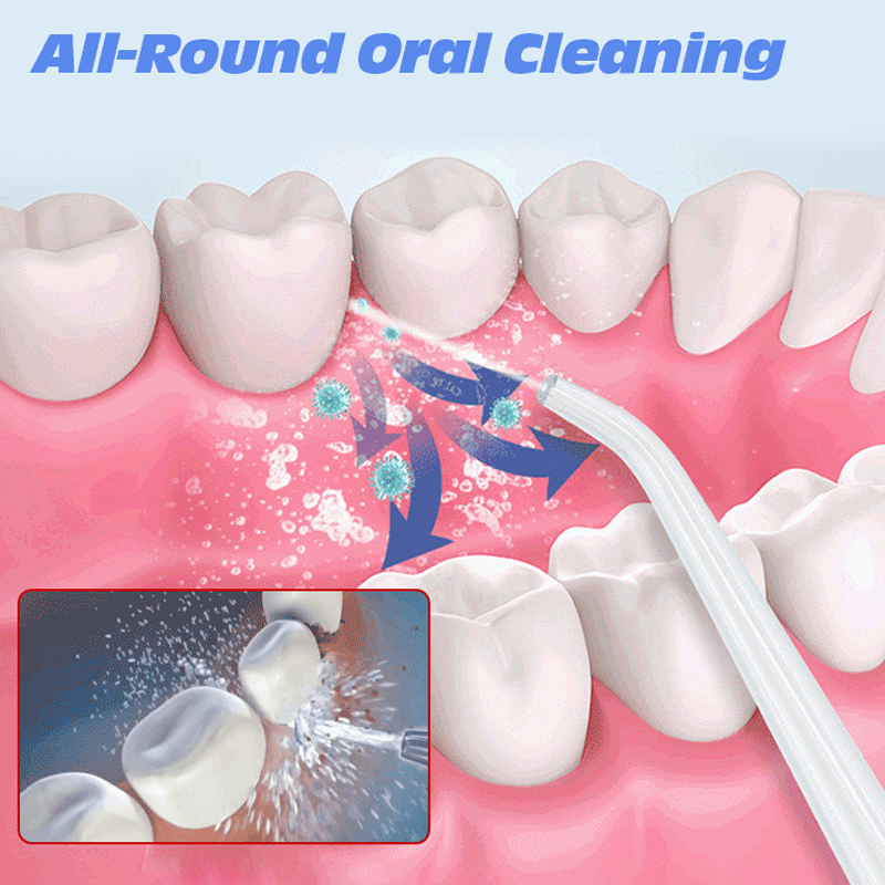 🦷 Tragbare Munddusche🚿 Variable Frequenz🔁 Tiefenreinigung für Zähne💎